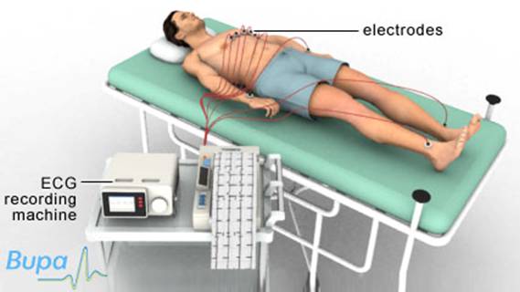 ecg_resting_427x240